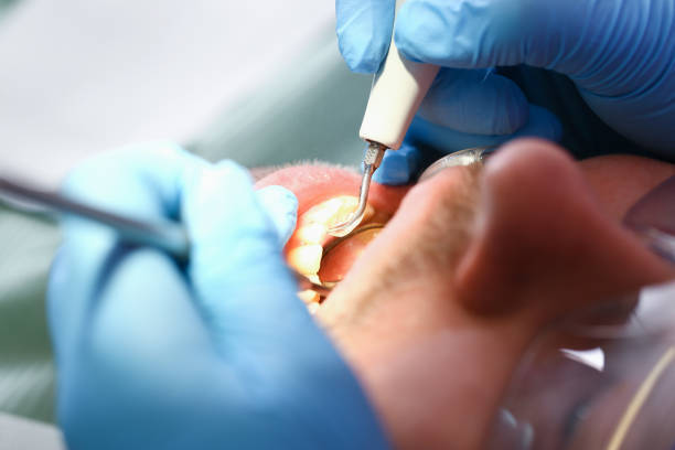 Best Urgent Dental Care for Toothache in Liverpool, NY