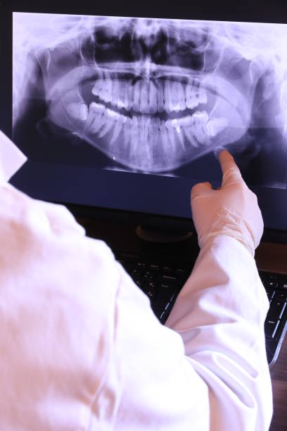 Best Broken or Cracked Tooth Emergency Dentist in Liverpool, NY
